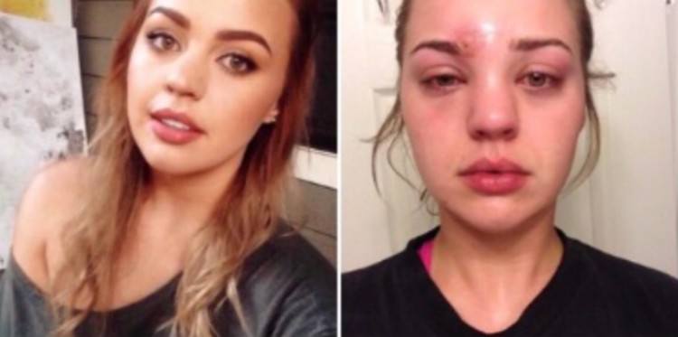 splitscreen of Katie Wright before and after staph infection
