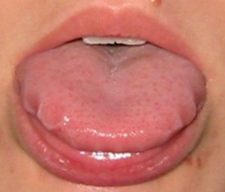 Tongue with a wavy outer edge.