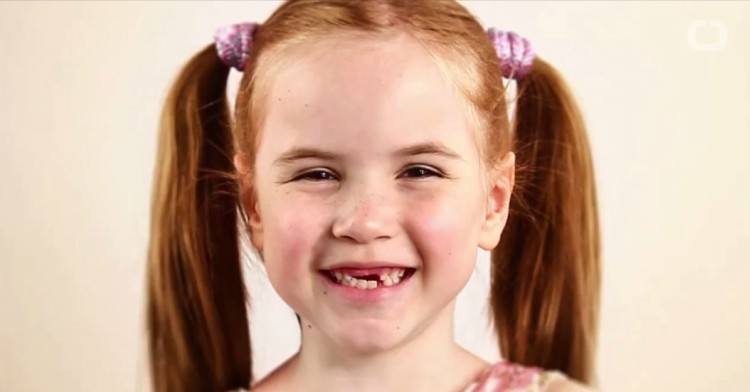 Image of little girl with freckles.