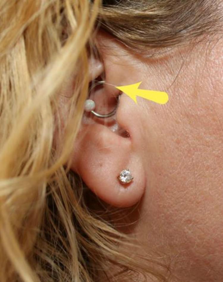 Nicole Bandes' daith piercing.