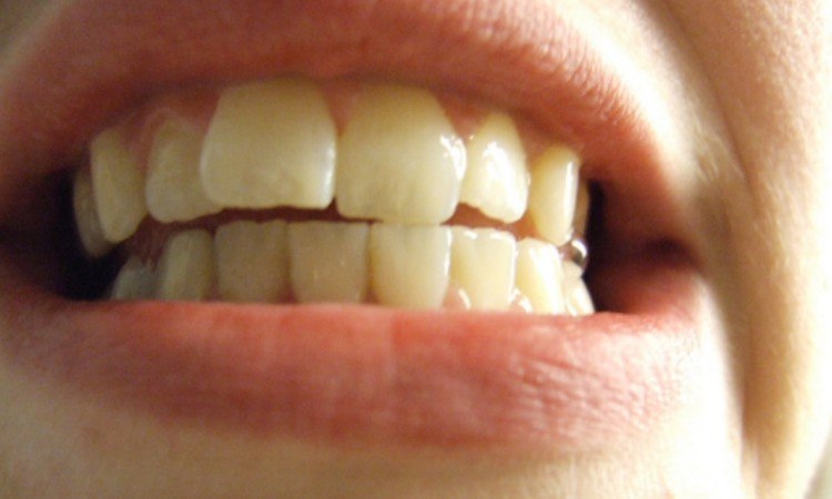 smile