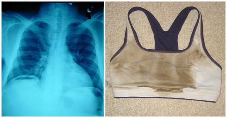 body chest featured