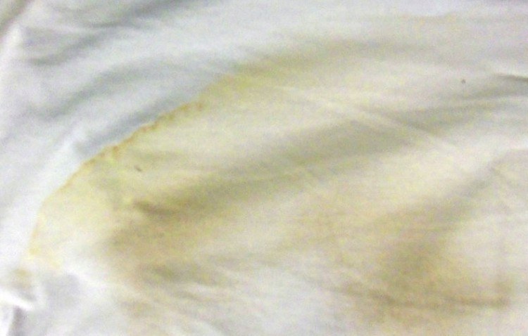arm pit stain