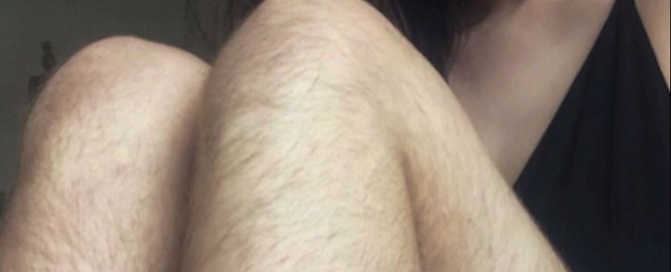 Image of unshaved legs.