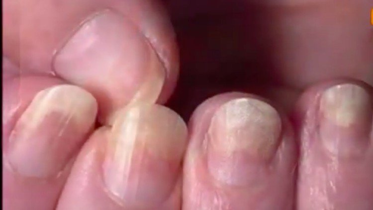pale nails