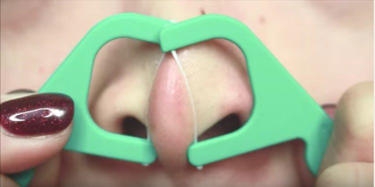floss extractions