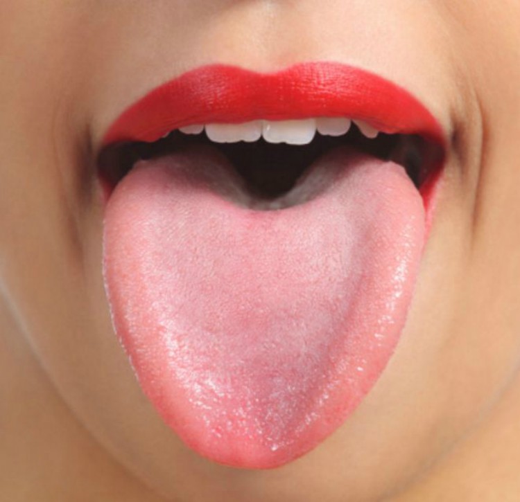 An example of a healthy tongue.