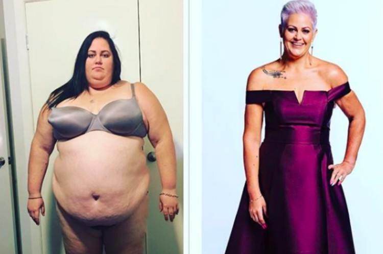 side by side before and after weight loss