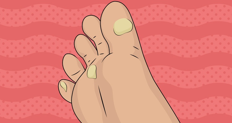 11 Reasons Why Your Feet Constantly Hurt and How to Fix It