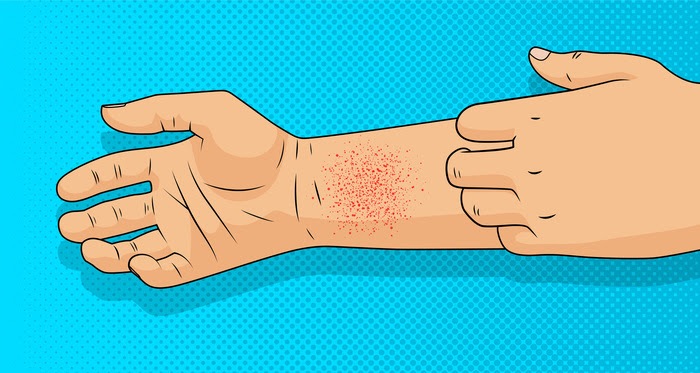 Scratching at an arm rash.